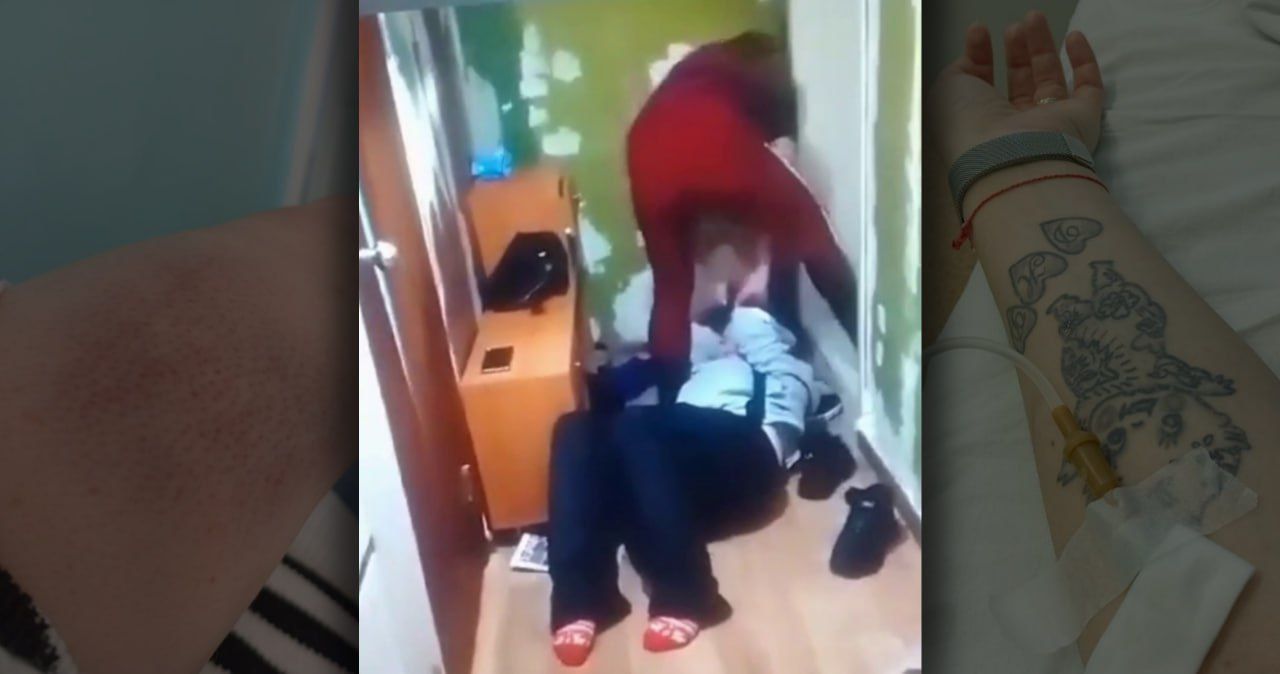 У избитой женщины все-таки обнаружили черепно-мозговую травму. Делом заинтересовалась прокуратура