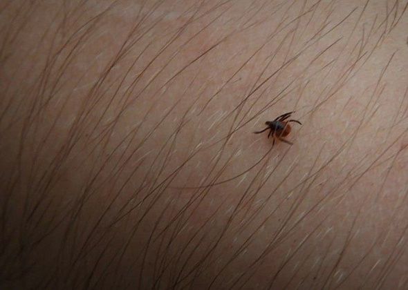 С начала сезона в Карпинскую ЦГБ с жалобами на укусы клеща обратились пять человек